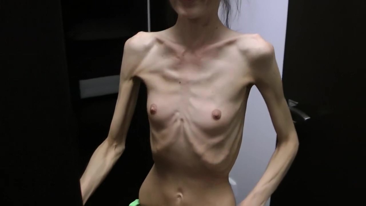 Booter reccomend anorexic denisa posing ribs touched