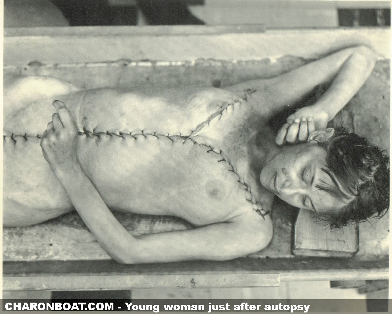 Autopsy naked woman erotic
