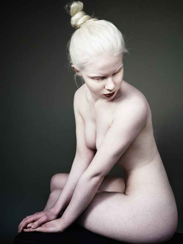 best of Ebony albino